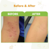 Picture of After Bite Soothing Cream (20ml)